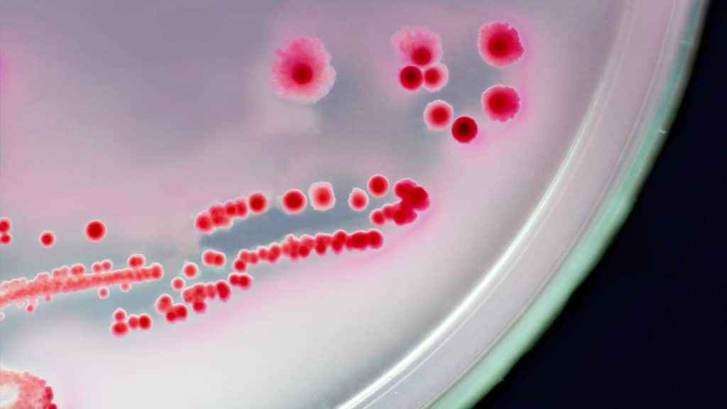 علامات نقص بكتيريا النافعة الصحية لجسم الإنسان 