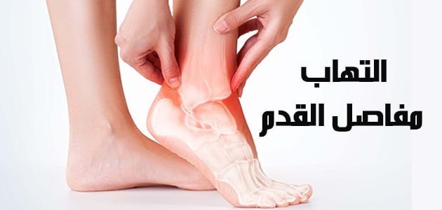 التهاب مفاصل القدم