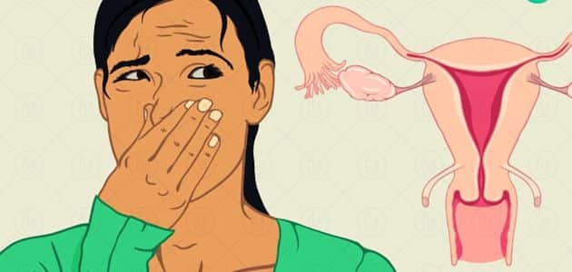 علاج رائحة المهبل الكريهة للبنات