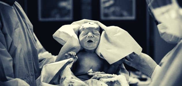 نصائح الولادة القيصرية للجنين